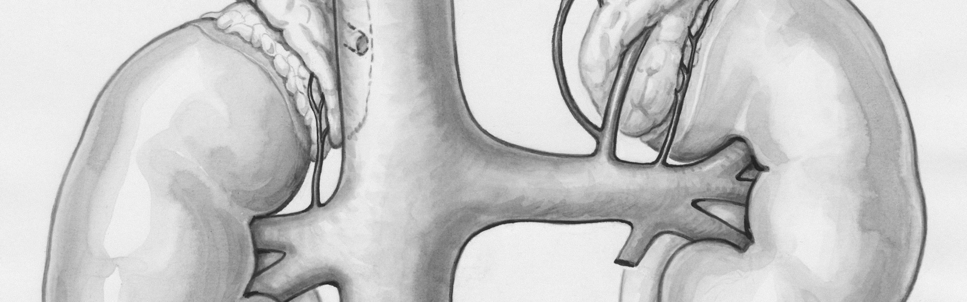 kidney